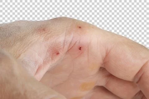 Cat bite marks on hand, isolated Stock Photos