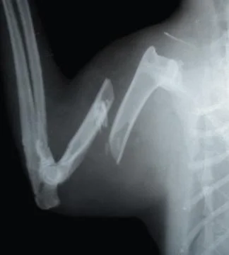 Cat, X-ray Stock Photos