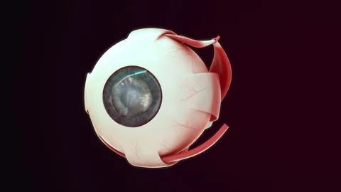 Cataract eye diseases of 3d illustrator Stock Illustration