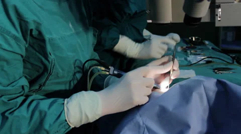 Cataract eye surgery. Surgeons team performing operation eye cataract. Tilt up. Stock Footage 34632753