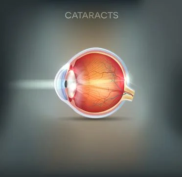Cataracts abstract grey background Stock Illustration