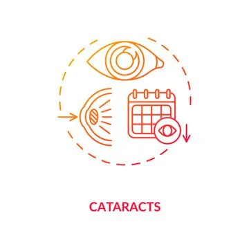 Cataracts concept icon Illustrazione stock
