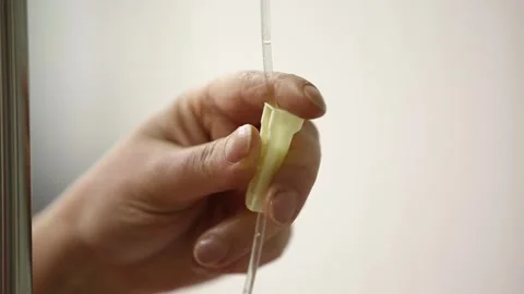 Catheter connection 3 Video stock 317081145