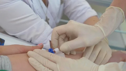A catheter is placed in a vein Video stock 121985672
