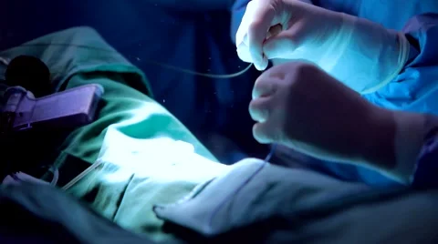 Catheterization Hands close up Stock Footage 44240346