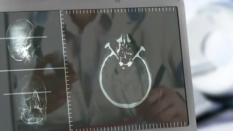 CATscan Stock Footage 73007994