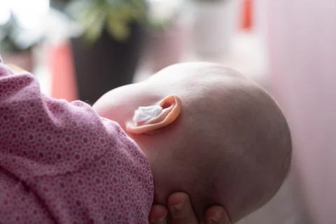 Caucasian baby with medication in ear. Infection treatment Stock Photos