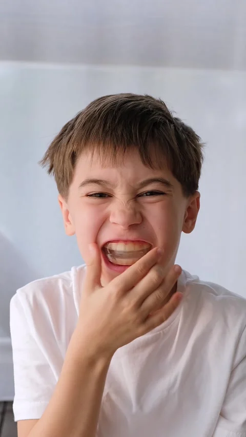 Caucasian child uses the aligner. A young boy puts a clear orthodontic Stock Footage 345650799