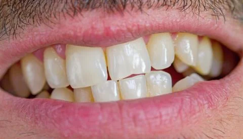 Caucasian man teeth Stock Photos