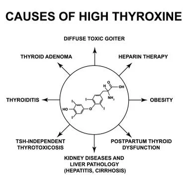 Causes of high thyroxine. Thyroid hormone thyroxine chemical molecular formula Illustrazione stock