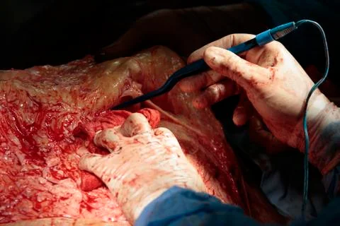 Cauterization Фото