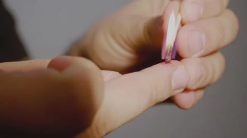 Cauterization of wart. The man cauterizes the wound on his finger with a match. Stock Footage 141001282