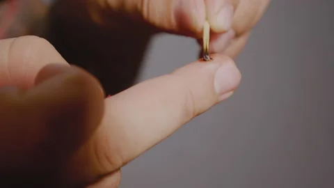 Cauterization of wart. The man cauterizes the wound on his finger with a match. Video stock 141001312