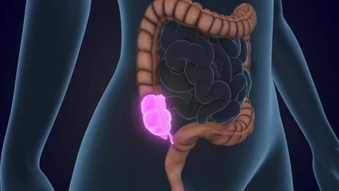 The Cecum is a section of the large intestine 스톡 동영상 310937536