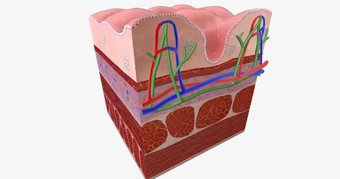 Celiac Disease is a chronic condition characterized an inflammatory allergi.. Illustrazione stock