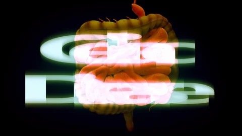 Celiac Disease Stock Footage 123270586