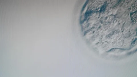 A cell moving under a microscope in laboratory. Ivf, In Vitro Fertilisation Stock Footage 124428871