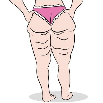 Celllulite thighs Stock Illustration