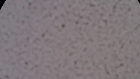 Cells finding with microscope Stock Footage 75784393