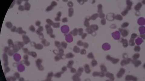 Cells finding with microscope Stock Footage 75784754