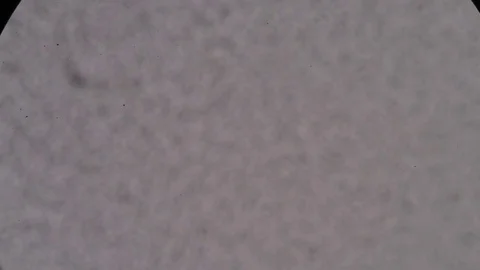 Cells finding with microscope Stock Footage 75784785