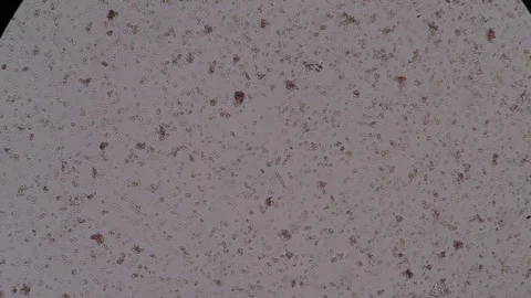 Cells finding with microscope Stock Footage 75784829