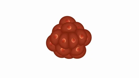 Cells growing to malignant tumor Vidéo 116049330