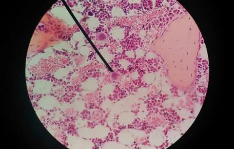 Cells of human find with microscope. Stock Photos