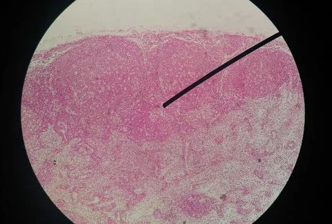 Cells of human find with microscope. Stock Photos