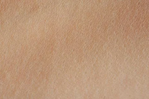 Cells on human skin Stock Photos