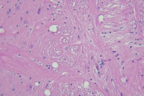 Cells in the microscope Stock Photos