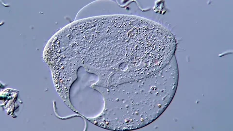 Cellular Destruction of Ciliates Under the Microscope, 400x 動画素材 317956835