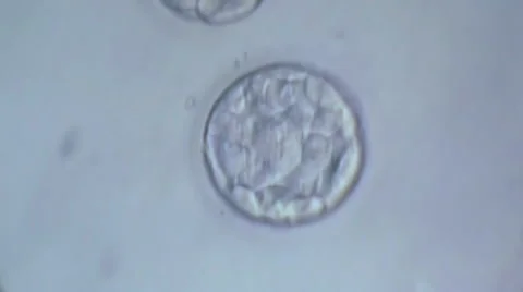 Cellular division of an in vitro fetus under microscope. Generic cell dividing. 動画素材 56816017