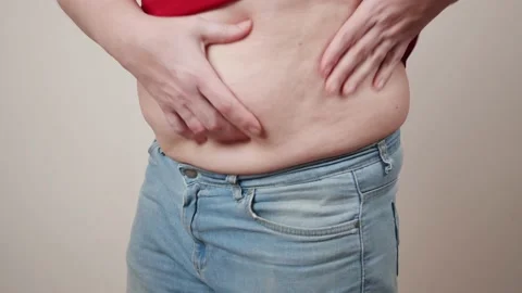 Cellulite and fat on the stomach of an elderly woman. 库存影片 144089615