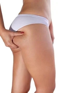 Cellulite and stretch marks on buttocks Stock Photos