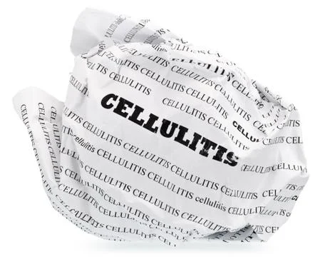 Cellulite is nervous? Throw Stock Photos