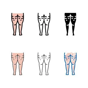 Cellulite problem color designs icon vector Stock Illustration