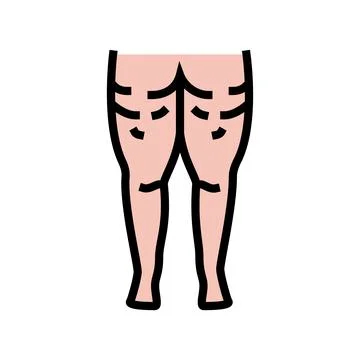 Cellulite problem color icon vector illustration Stock Illustration