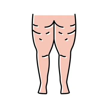 Cellulite problem color icon vector illustration Illustrazione stock