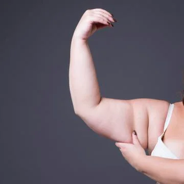 Cellulite on a woman's hand Stock Photos