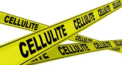 Cellulite. Yellow warning tapes Stock-Illustration