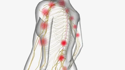 Central Sensitization Heightened sensitivity along spinal cord Stock Footage 245280837