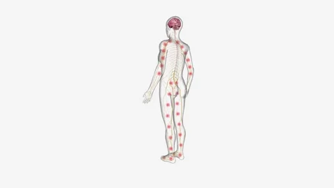 Central sensitization, the process by which the central nervous system processes Stock Footage 245277651