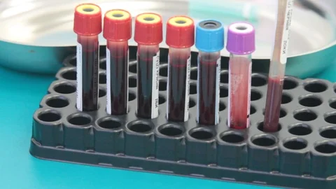 Centrifuge tubes Stock Footage 86275290