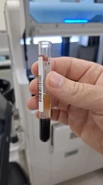 Centrifuged Blood Sample Close-up Stock-Fotos