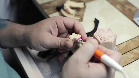 Ceramet implant creature process at laboratory. Stock Footage 70839230