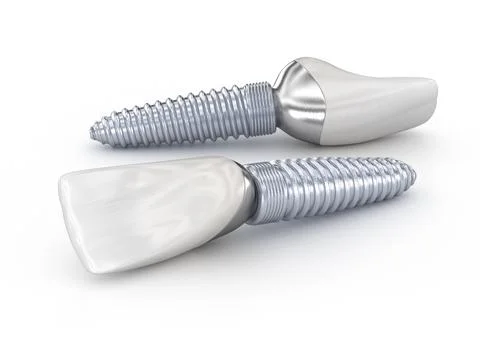 Ceramic crown, custom implant abutment and implantat. Stock Illustration