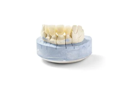 Ceramic crown of a tooth on plaster model Stock Photos