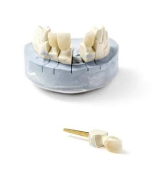 Ceramic crown of a tooth on plaster model Stock Photos