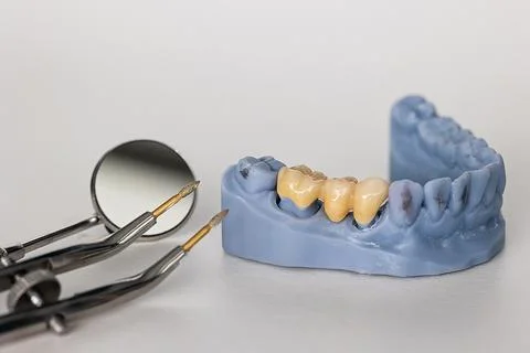 Ceramic dental bridge on 3D model with dental mirror and diamond burs Stock Photos
